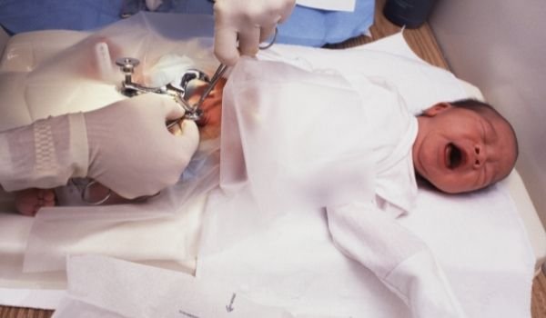 Pros y contras de la circuncisión